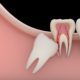 denti del giudizio