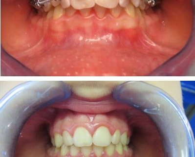 Domande frequenti di ortodonzia