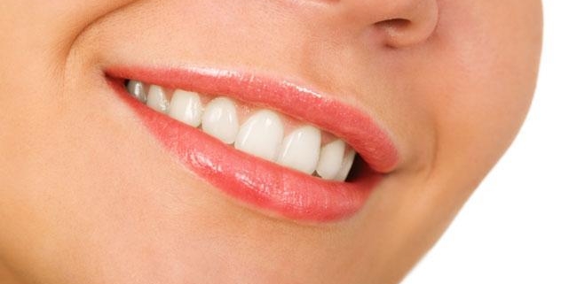 Impianti in ceramica